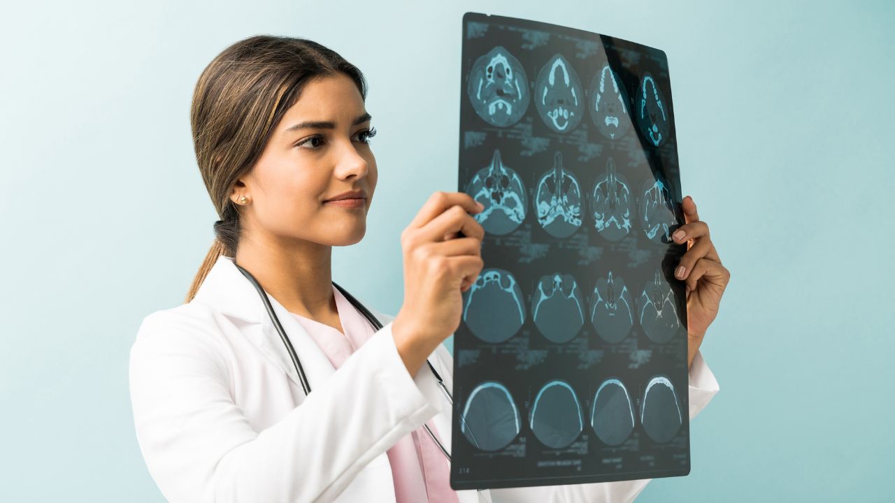 Consulta com Neurologista na UltraCare